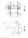 Fig. 17 - System and apparatus for adjustable gastric bypass