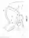 Fig. 19 - System and apparatus for adjustable gastric bypass