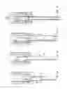 Fig. 08 - METHOD AND APPARATUS FOR TREATING URETHRAL STRICTURE