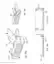 Fig. 17 - METHOD AND APPARATUS FOR TREATING URETHRAL STRICTURE