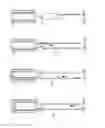 Fig. 33 - METHOD AND APPARATUS FOR TREATING URETHRAL STRICTURE