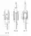 Fig. 04 - METHOD AND APPARATUS FOR TREATING URETHRAL STRICTURE