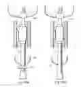 Fig. 31 - METHOD AND APPARATUS FOR TREATING URETHRAL STRICTURE