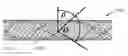 Fig. 01 - EXTERNAL SUPPORT FOR ELONGATED BODILY VESSELS
