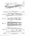 Fig. 02 - EXTERNAL SUPPORT FOR ELONGATED BODILY VESSELS