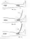 Fig. 08 - EXTERNAL SUPPORT FOR ELONGATED BODILY VESSELS