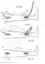 Fig. 09 - EXTERNAL SUPPORT FOR ELONGATED BODILY VESSELS