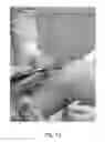 Fig. 16 - Apparatus and method for clamping and trimming the bone tendon portion of a graft to a desired size