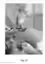 Fig. 25 - Apparatus and method for clamping and trimming the bone tendon portion of a graft to a desired size