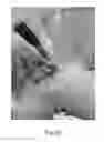 Fig. 37 - Apparatus and method for clamping and trimming the bone tendon portion of a graft to a desired size