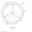 Fig. 12 - CUT PATTERN TRANSCATHETER VALVE FRAME