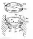 Fig. 01 - Heart valve annulus device and method of using same