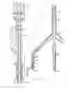 Fig. 05 - Heart valve annulus device and method of using same