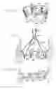Fig. 10 - Heart valve annulus device and method of using same