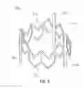 Fig. 04 - Artificial heart valve with scalloped frame design