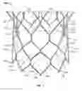 Fig. 02 - Commissure attachment feature for prosthetic heart valve
