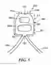 Fig. 05 - Commissure attachment feature for prosthetic heart valve