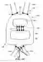Fig. 07 - Commissure attachment feature for prosthetic heart valve