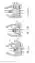 Fig. 16 - PROSTHETIC IMPLANT DELIVERY DEVICE