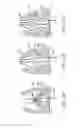 Fig. 17 - PROSTHETIC IMPLANT DELIVERY DEVICE