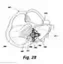 Fig. 11 - Sensors for prosthetic heart devices