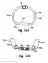 Fig. 13 - Sensors for prosthetic heart devices