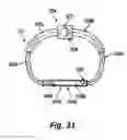 Fig. 14 - Sensors for prosthetic heart devices