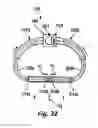 Fig. 15 - Sensors for prosthetic heart devices