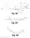 Fig. 28 - Sensors for prosthetic heart devices