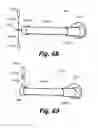 Fig. 33 - Sensors for prosthetic heart devices