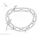 Fig. 01 - Annulus rings with suture clips