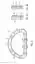 Fig. 03 - Annulus rings with suture clips