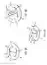 Fig. 04 - Annulus rings with suture clips