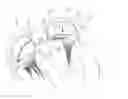 Fig. 01 - Cardiac valve commissure brace