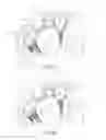 Fig. 08 - Cardiac valve commissure brace