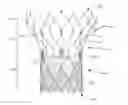 Fig. 01 - Prosthetic heart devices having diagnostic capabilities