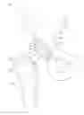 Fig. 01 - Composite prosthetic surfaces