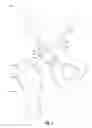 Fig. 03 - Composite prosthetic surfaces