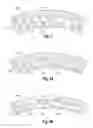Fig. 05 - Composite prosthetic surfaces