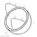 Fig. 02 - ACETABULAR CUP PROSTHESIS