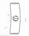 Fig. 07 - ACETABULAR CUP PROSTHESIS