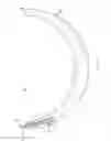 Fig. 19 - ACETABULAR CUP PROSTHESIS
