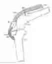 Fig. 01 - Methods of redistributing forces for the patella with spacers