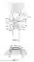 Fig. 12 - Methods of redistributing forces for the patella with spacers