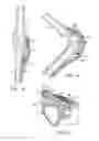 Fig. 15 - Methods of redistributing forces for the patella with spacers