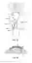 Fig. 18 - Methods of redistributing forces for the patella with spacers