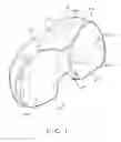 Fig. 02 - Tibial bearing component for a knee prosthesis with improved articular characteristics