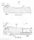 Fig. 04 - Tibial bearing component for a knee prosthesis with improved articular characteristics