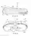 Fig. 05 - Tibial bearing component for a knee prosthesis with improved articular characteristics