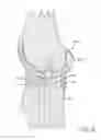Fig. 07 - Tibial bearing component for a knee prosthesis with improved articular characteristics